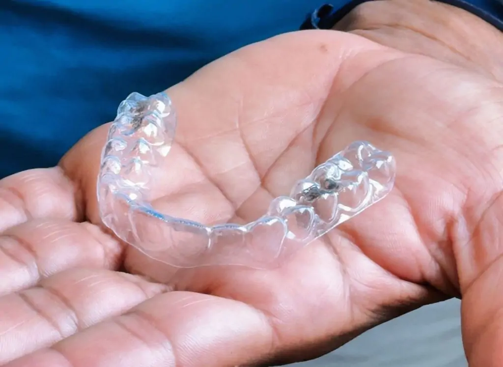 Dentista Dental Family Bari: consigli per lavare gli allineatori trasparenti!