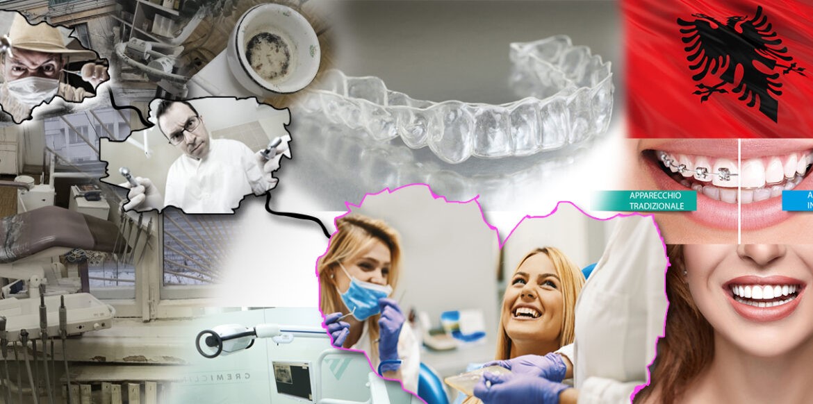 Il dentista della Dental Family Bari sul caso Albania